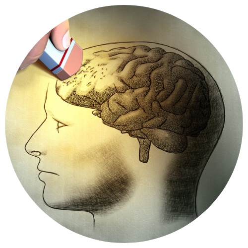Alzheimer’s Disease