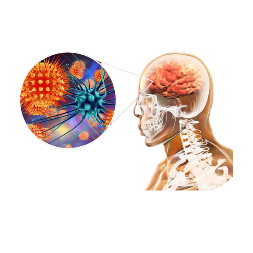 Meningitis & Encephalitis