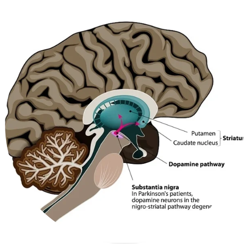Parkinson’s Disease